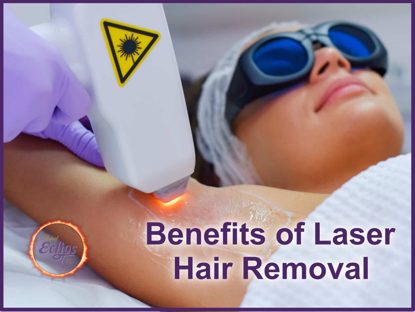 Benefits of Laser Hair Removal